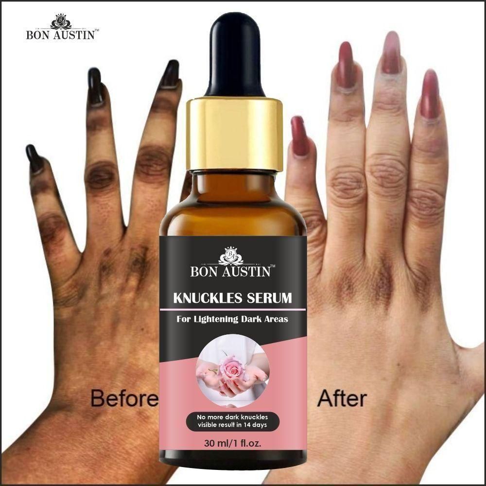 Bon Austin Skin Whitening Serum - AmazingBaba