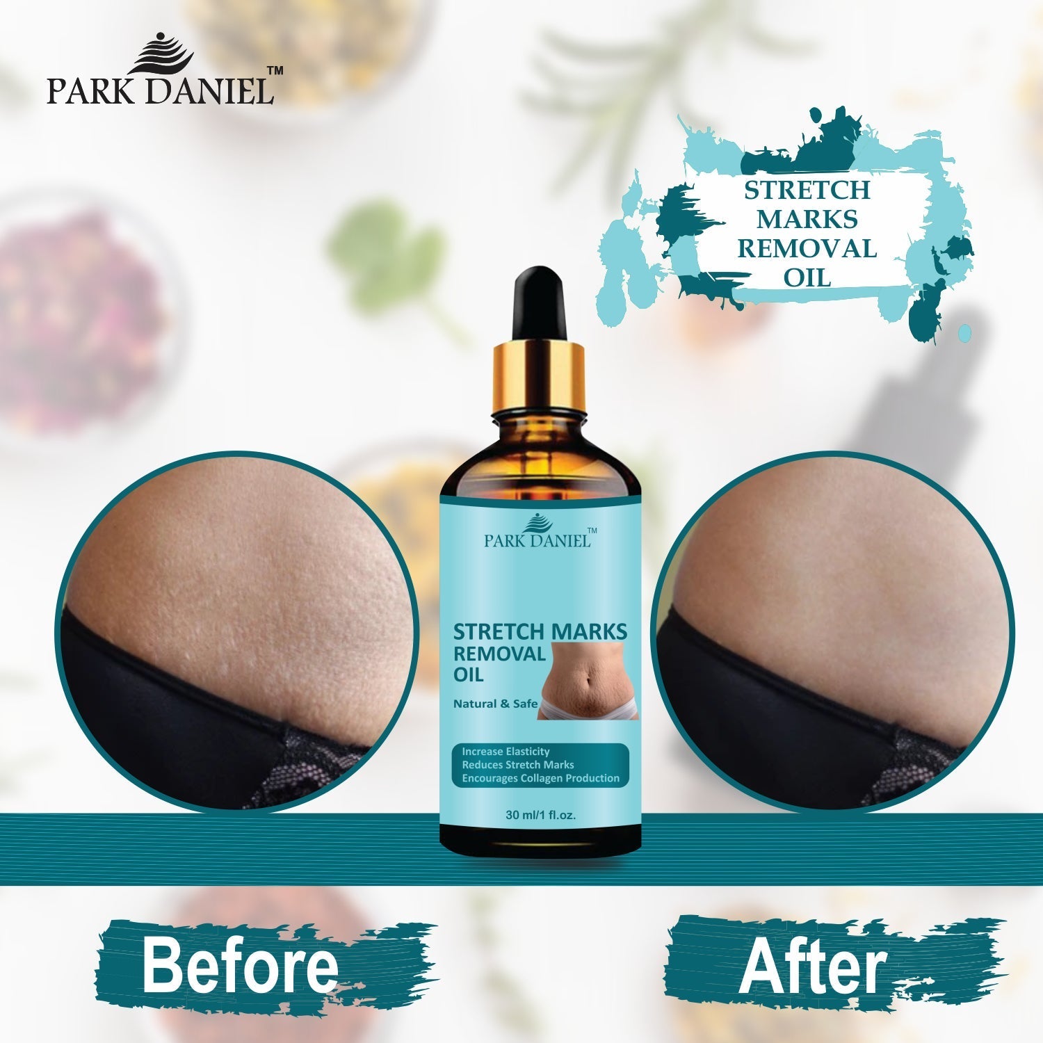 Park Daniel Premium Stretch Marks Removal Oil - AmazingBaba