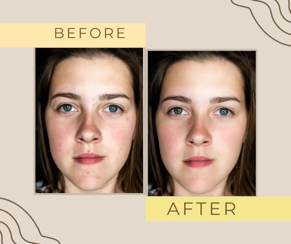 OMICARE organics Skin glow and Whitening Cream - AmazingBaba