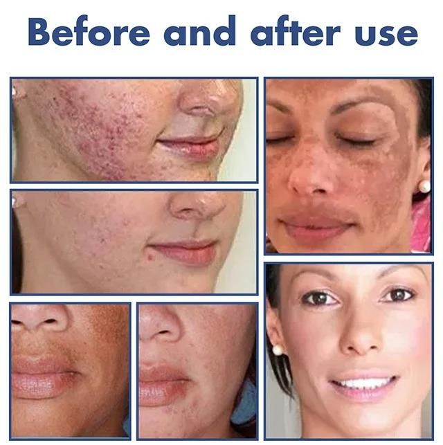 Blackthorn Skin Cleanser(Pack Of 2) - AmazingBaba