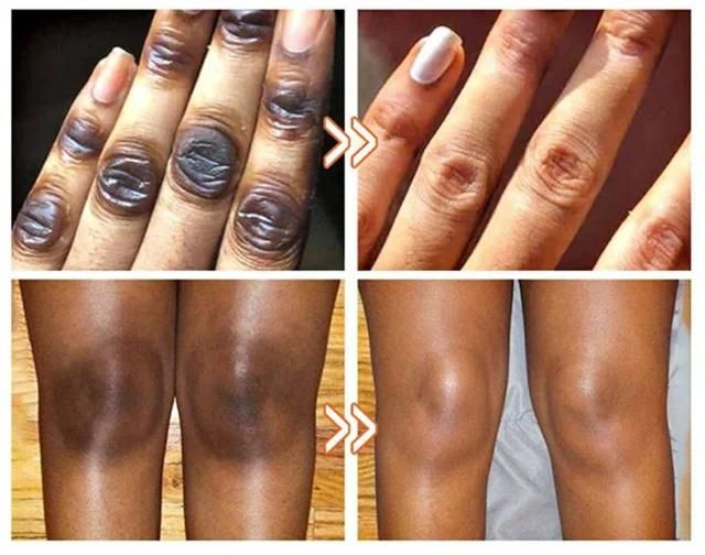 Blackthorn Skin Cleanser(Pack Of 2)