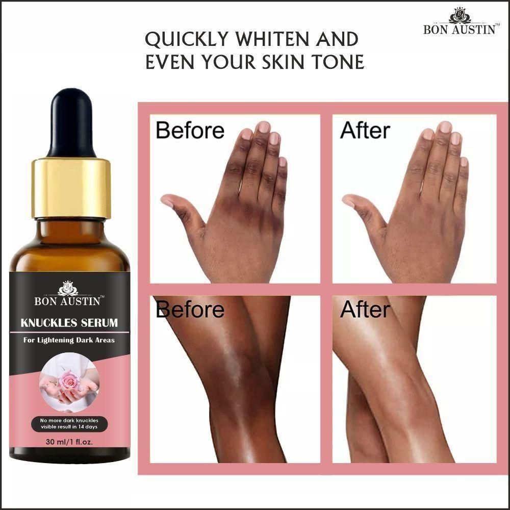 Bon Austin Skin Whitening Serum - AmazingBaba